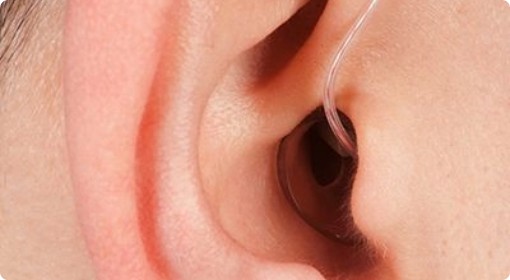 CAN HEARING AIDS TRIGGER EARWAX PRODUCTION?