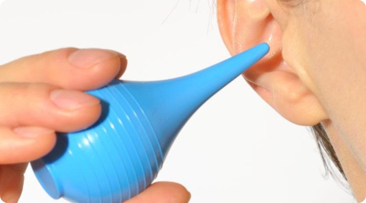 Earwax Removal Tips